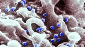  Imagem de microscópio colorida artificialmente mostrando o vírus HIV atacando células de defesa em laboratório (Kallista Images)