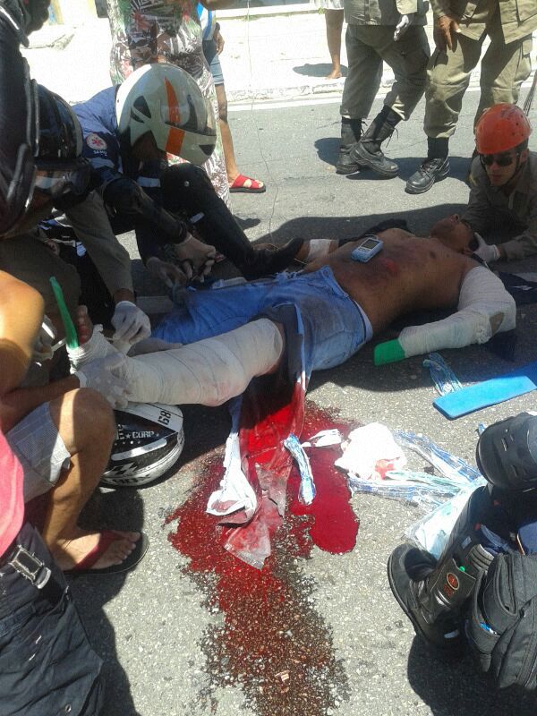 Acidente grave na Beira Mar deixa motociclista ferido