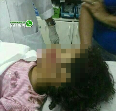 Tiro atinge rosto de menina durante perseguição em Maruim, em SE