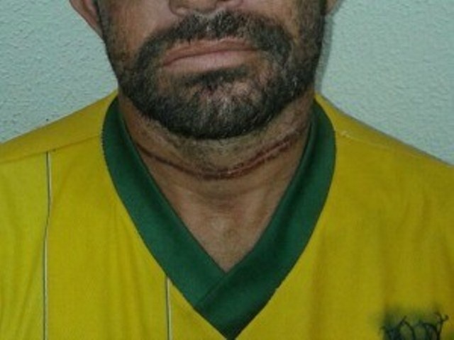 Homem é torturado e enterrado vivo e sai de cova sozinho em Fortaleza 