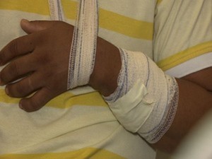 Tiro pegou de raspão (Foto: Reprodução/TV Sergipe)