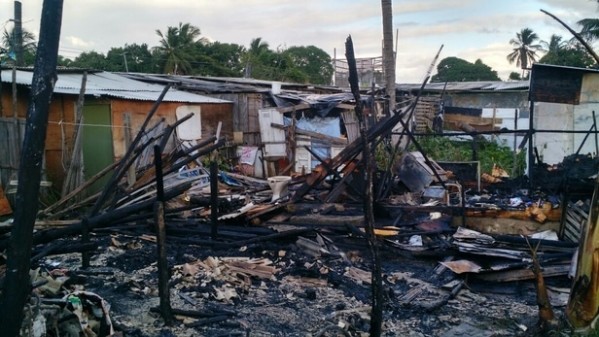 Festejos juninos: Huse registra 30 atendimentos a vítimas de queimaduras