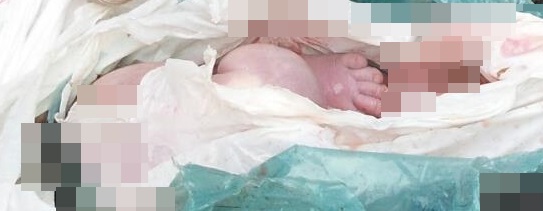 Recém-nascido é abandonado dentro de saco plástico em Tobias Barreto