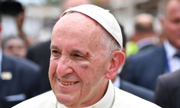 Pontíficie foi ferido no rosto durante visita a Cartagena 