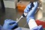 Pesquisa em Minas Gerais encontra coronavírus no esgoto