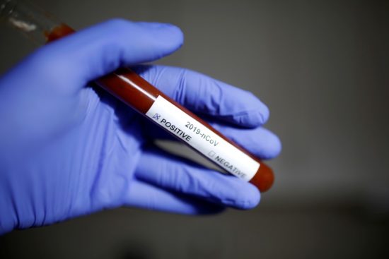 Sergipe registra quatro novos casos de Coronavírus e o primeiro em Simão Dias