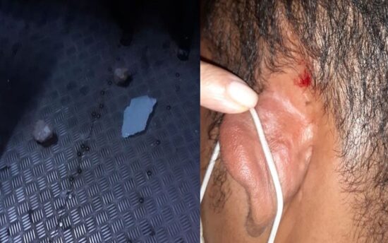 Cobrador é agredido com pedradas por tentar impedir usuário sem máscara de utilizar ônibus na Grande Aracaju