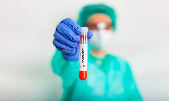 Agência Nacional de Vigilância Sanitária autoriza uso emergencial de kits para varíola dos macacos