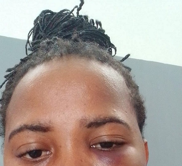 Mulher agredida por policial fala sobre o caso de violência em Cristinápolis