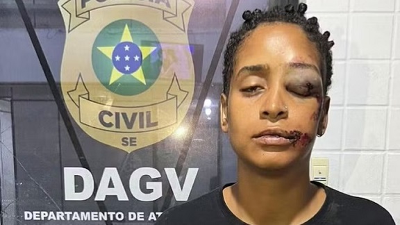 Polícia Civil identifica e intima um dos suspeitos de agressão, racismo e Lgbtfobia em lanchonete na capital