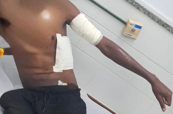 Adolescente de 17 anos é esfaqueado por mãe de colega dentro de ônibus escolar em São Cristóvão